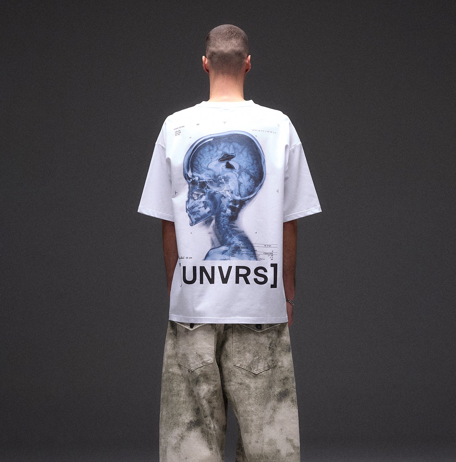 BRAIN SCAN TEE