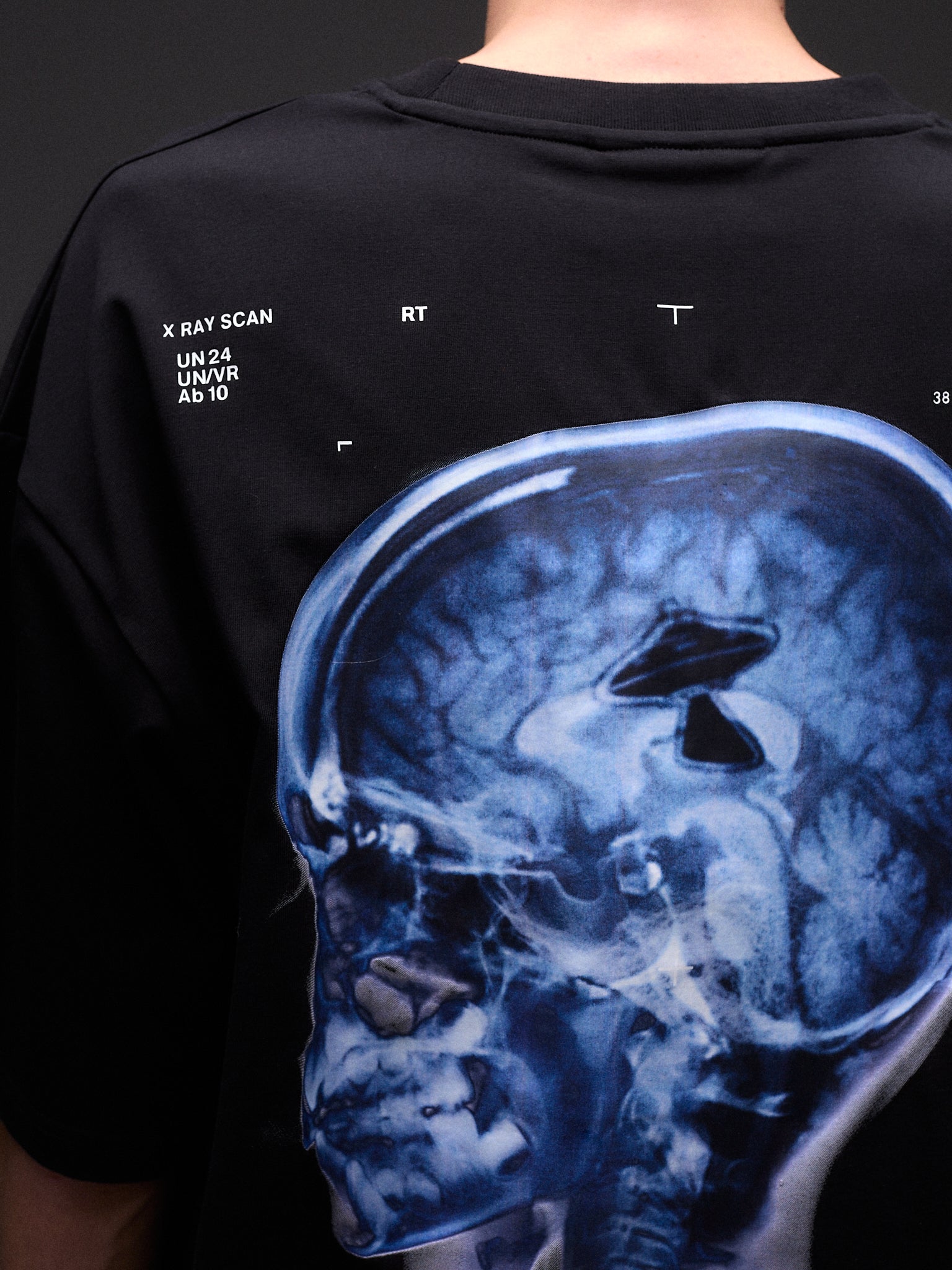 BRAIN SCAN TEE