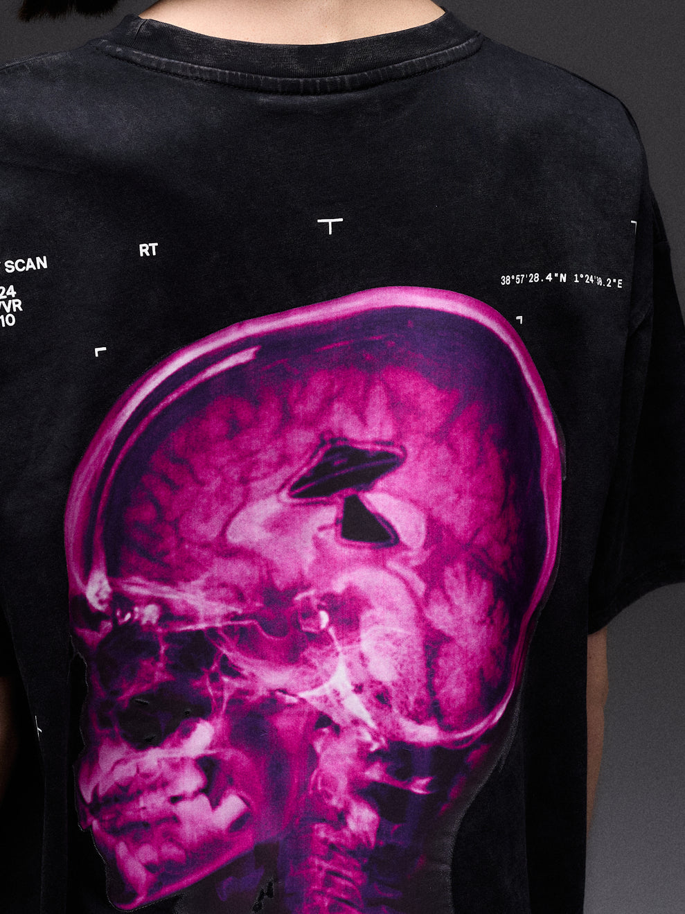 BRAINSCAN TEE